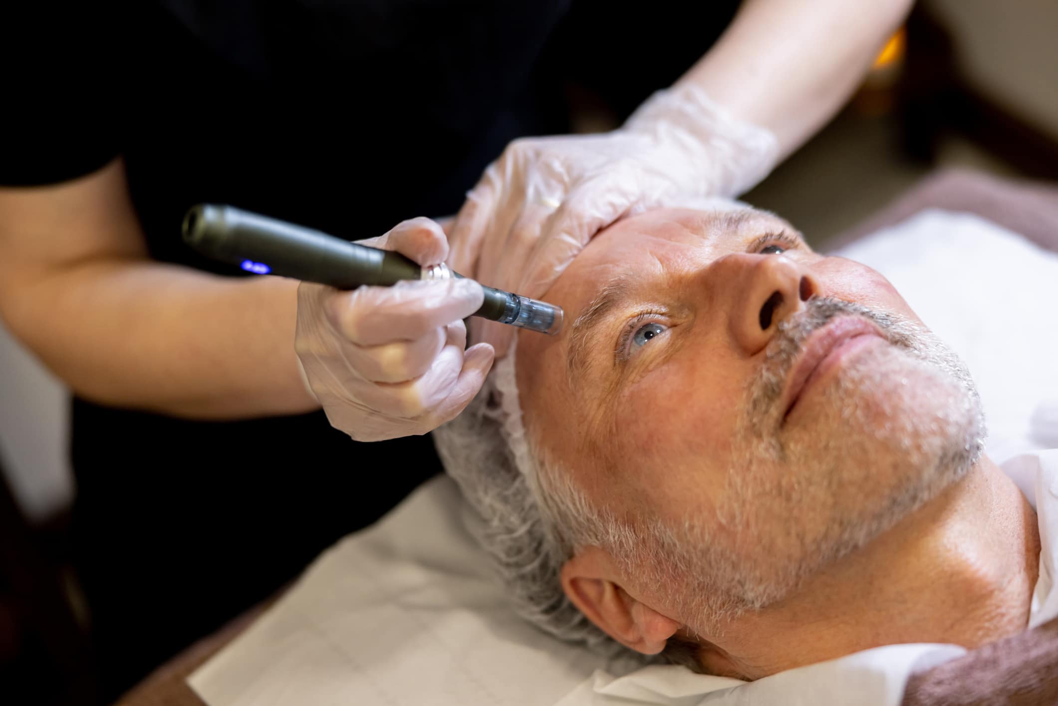 Shanni Sutton performing SkinPen microneedling on a patient.