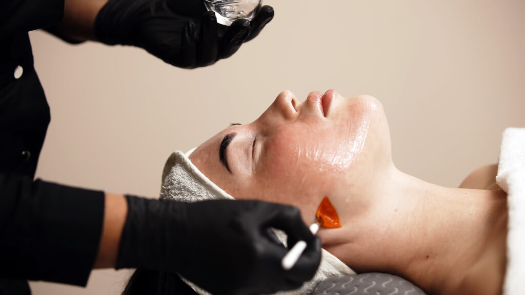 Cosmetologist applying a chemical peel to a client’s face.